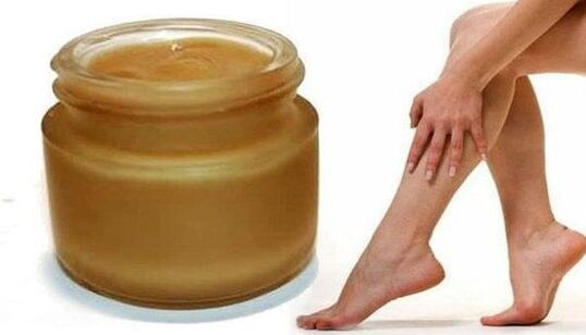 Osteurizer from varicose veins