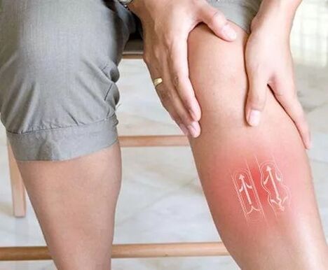 Dysfunction of venous blood flow in the lower limb