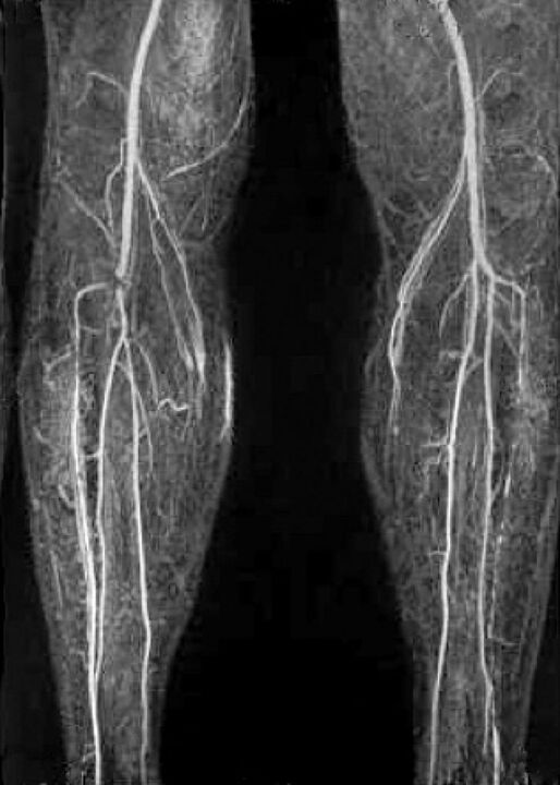 X -Mach x -ray