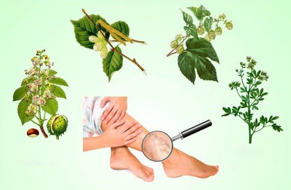 Herbs to treat varicose veins in the legs