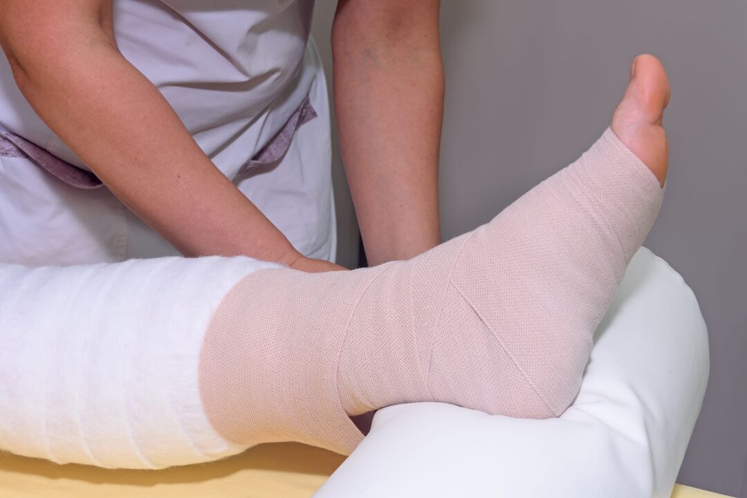 elastic bandage for varicose veins in men