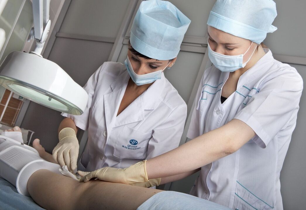 laser treatment for varicose veins